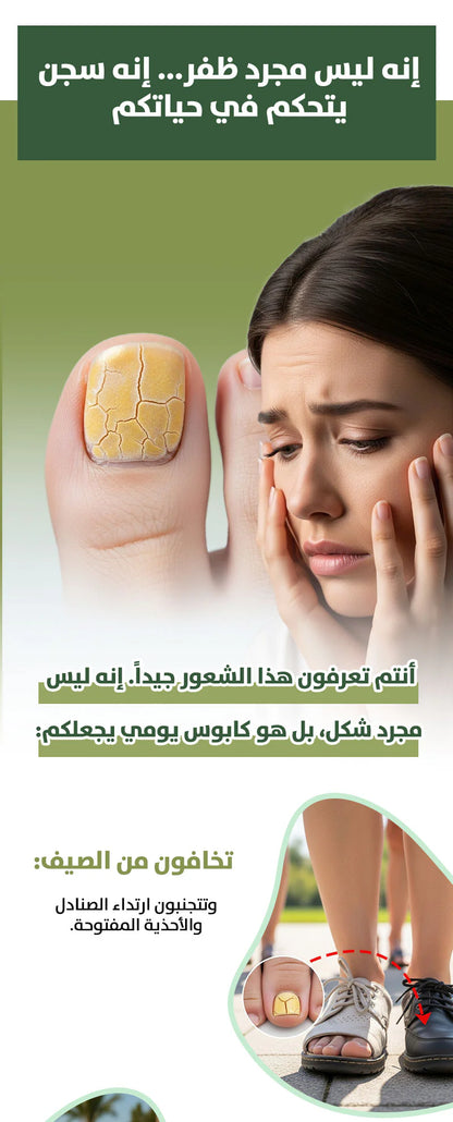 🔥 الأكثر طلباً ⭐️ سيروم South Moon لفطريات الأظافر العنيدة