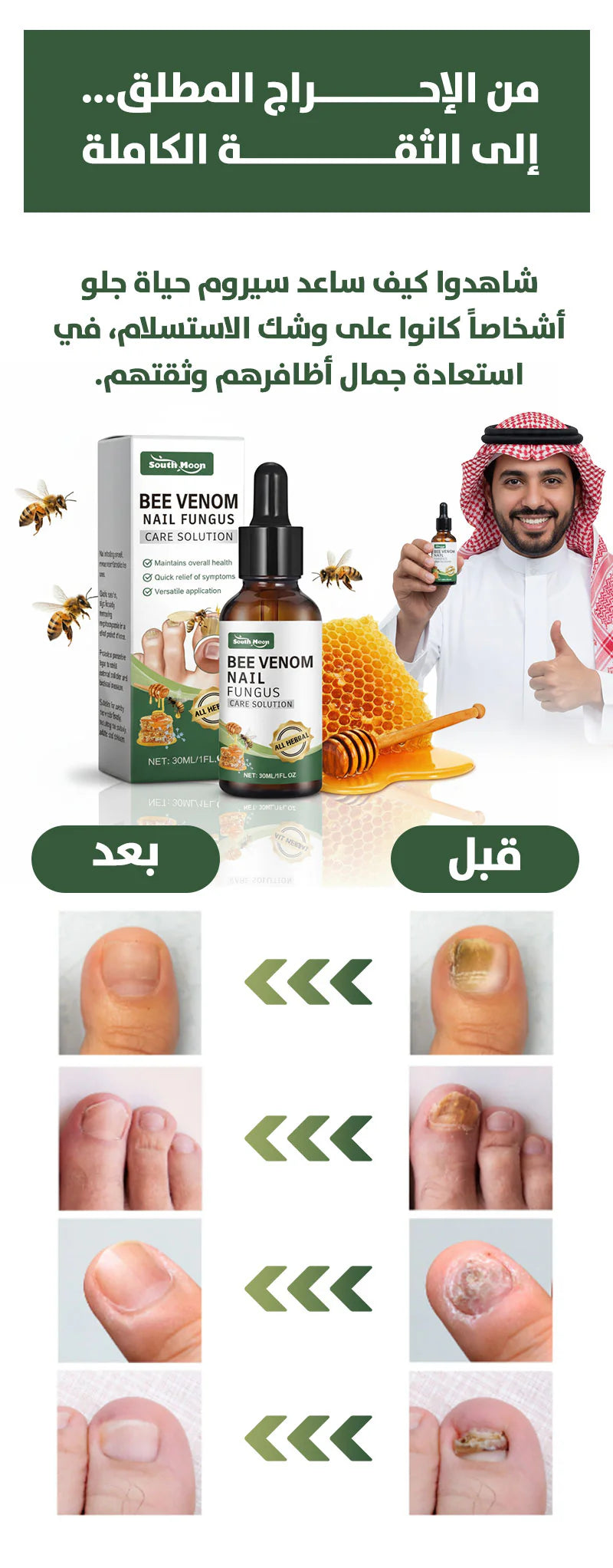 🔥 الأكثر طلباً ⭐️ سيروم South Moon لفطريات الأظافر العنيدة