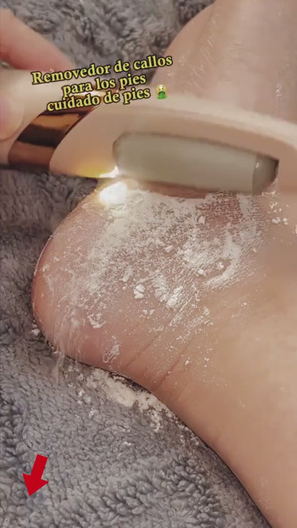 Electric Pedicure Foot File Callus Remover