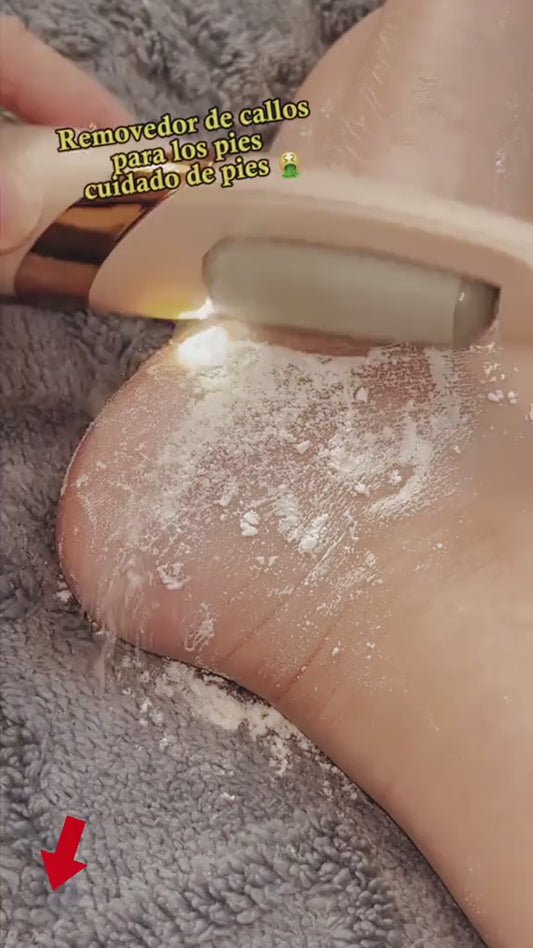 Electric Pedicure Foot File Callus Remover