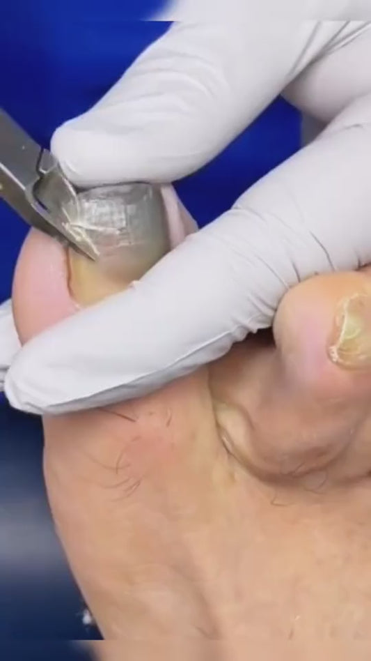 Hanel - Pain Relief Patch