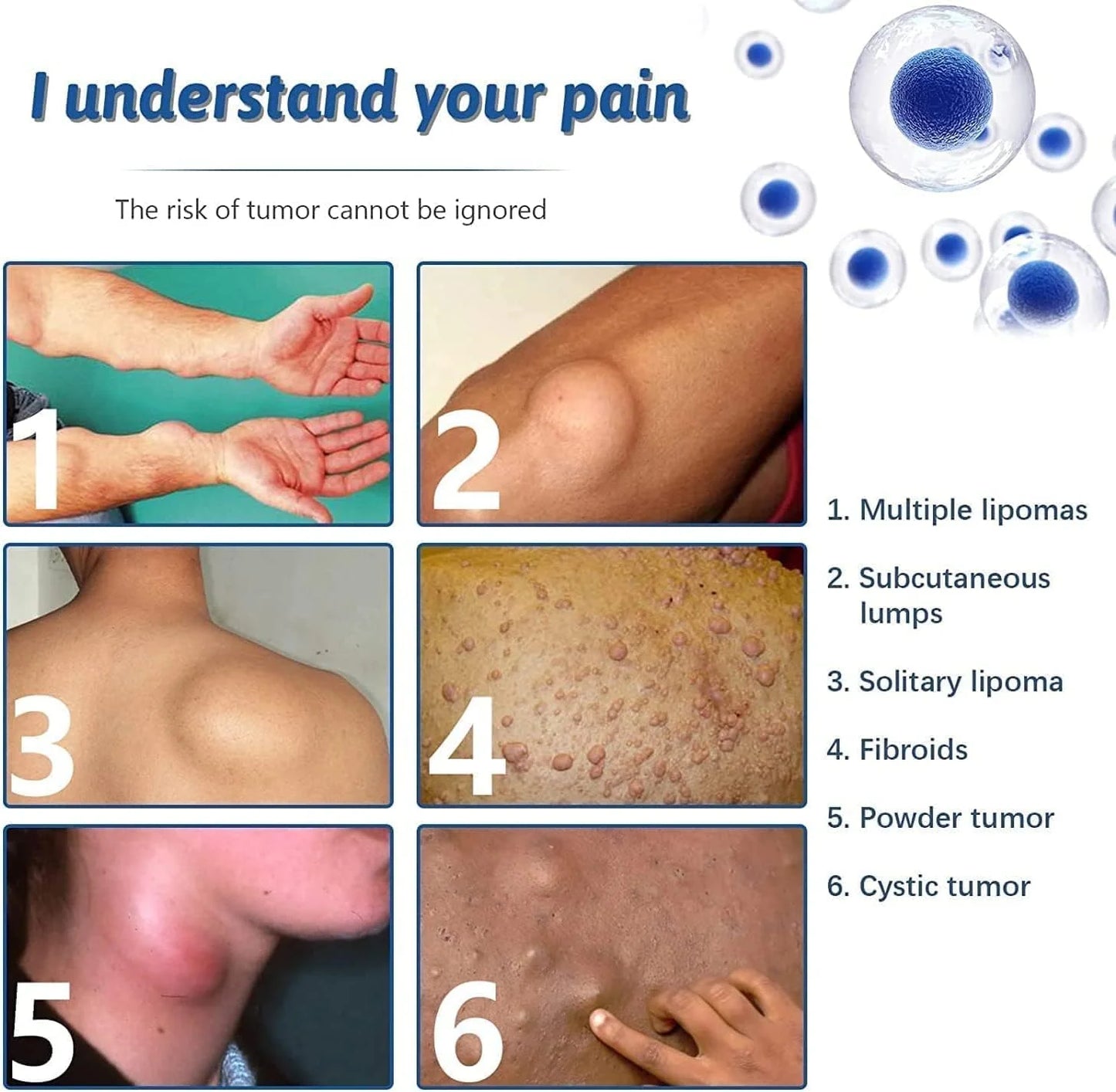 Lipoma Removal Spray